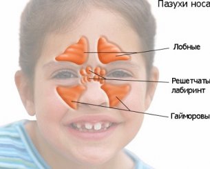 Признаки развития синусита у детей, основная схема лечения